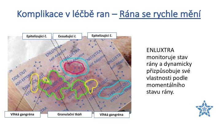 Enluxtra návod13